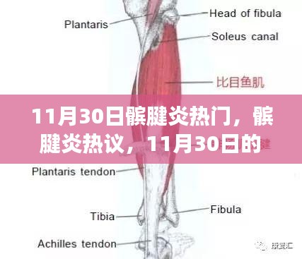 11月30日髌腱炎热议与个人立场，观点碰撞与髌腱炎的关注度