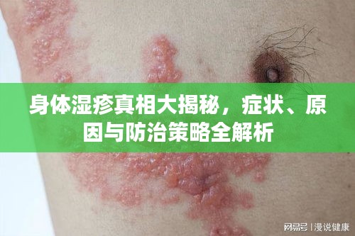 打张鸡儿
