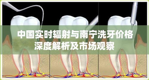 中国实时辐射与南宁洗牙价格深度解析及市场观察