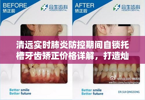清远实时肺炎防控期间自锁托槽牙齿矫正价格详解,打造灿烂笑容的全方位指南!
